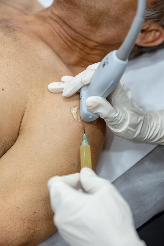 bloqueo nervioso vecindario